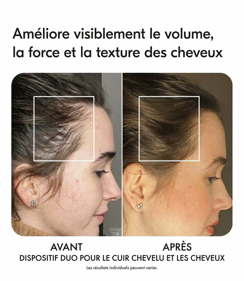 REVITAHAIR : L'ÉCLAT CAPILLAIRE